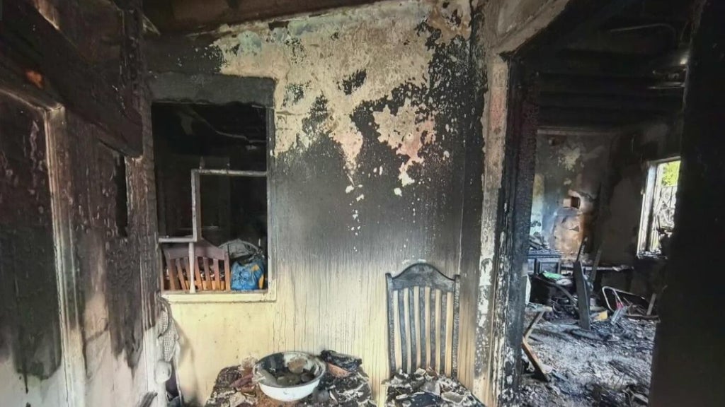 Woman hospitalized after Miami house fire leaves three displaced — CBS Miami, Fort Worth Health news
